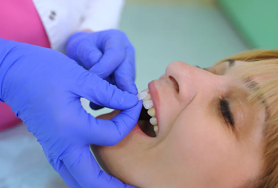 Dentist working on patients veneers in West Hollywood, CA